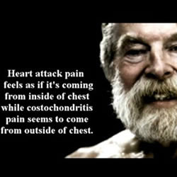 costochondritis
